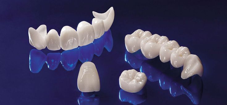 Zircon – Crowns & Bridges – Ceramic